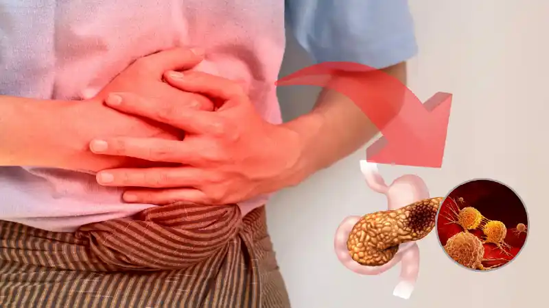 Four Stages of Pancreatitis