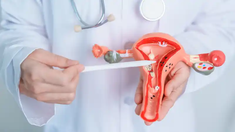 Hysterectomy Cost in India