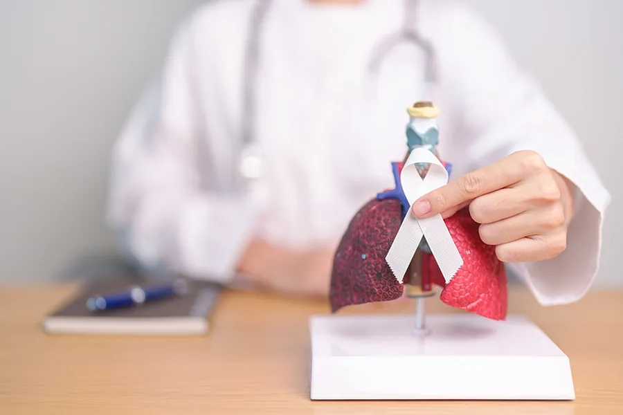 What are the Stages of Lung Cancer