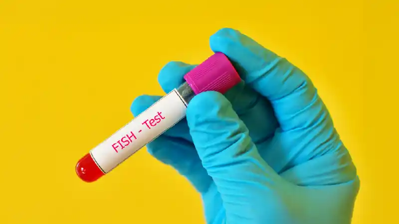 FISH Test for Cancer