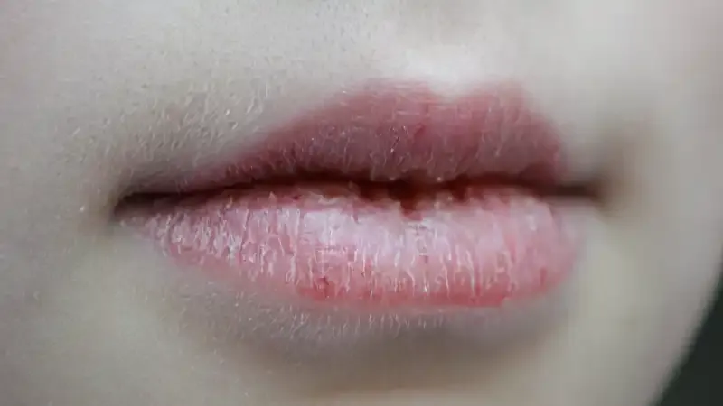 Lip Color Reveal About Your Health